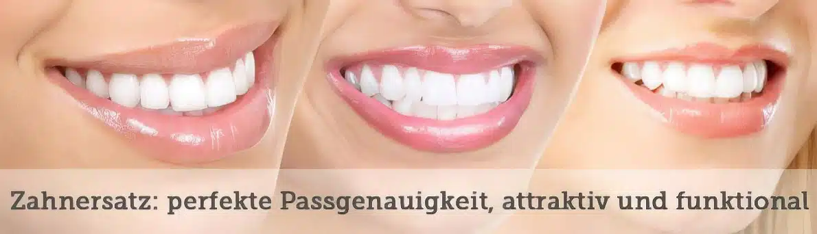 Zahnersatz: perfekte Passgenauigkeit, attraktiv und funktional
